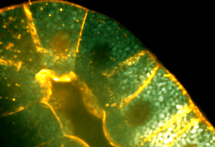 Membrane Homeostasis | Ori Avinoam