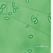 Kazachstania weizmannii, viewed under a microscope. (Image from the Jung lab)