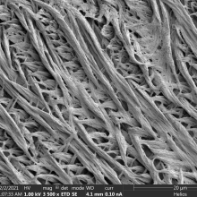 Scanning electron microscope images of enamel structure that developed abnormally after attacks by autoantibodies against enamel proteins. (Image from the Abramson lab)