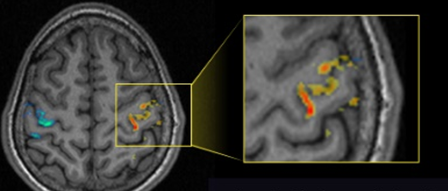 High-resolution functional MRI | Schmidt MRI lab