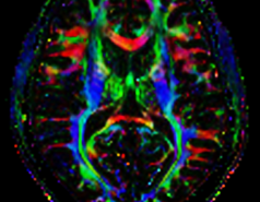 Diffusion Tensor Imaging at 7T picture no. 1