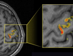 High-resolution functional MRI picture no. 1