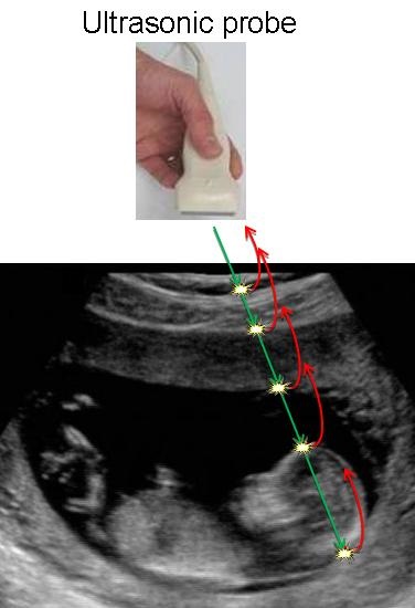 Ultrasonic Example