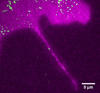 mRNA in tunneling nanotube