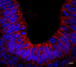 cell shedding into the lumen of E7.5 mouse embryo