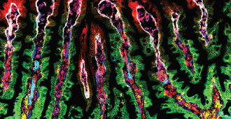 An image of tissue from the human small intestine obtained with the help of fluorescent dyes that made it possible to mark numerous proteins in parallel, thereby mapping out the various proteins produced in each part of the intestinal villi